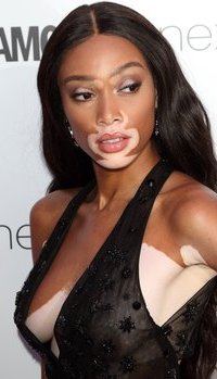 Winnie Harlow - The Glamour Women of the Year Awards 2017 | Picture 1504626